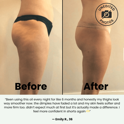 Alvyia Anti Cellulite Massage Oil