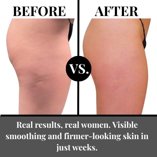 Alvyia Anti Cellulite Massage Oil 8oz